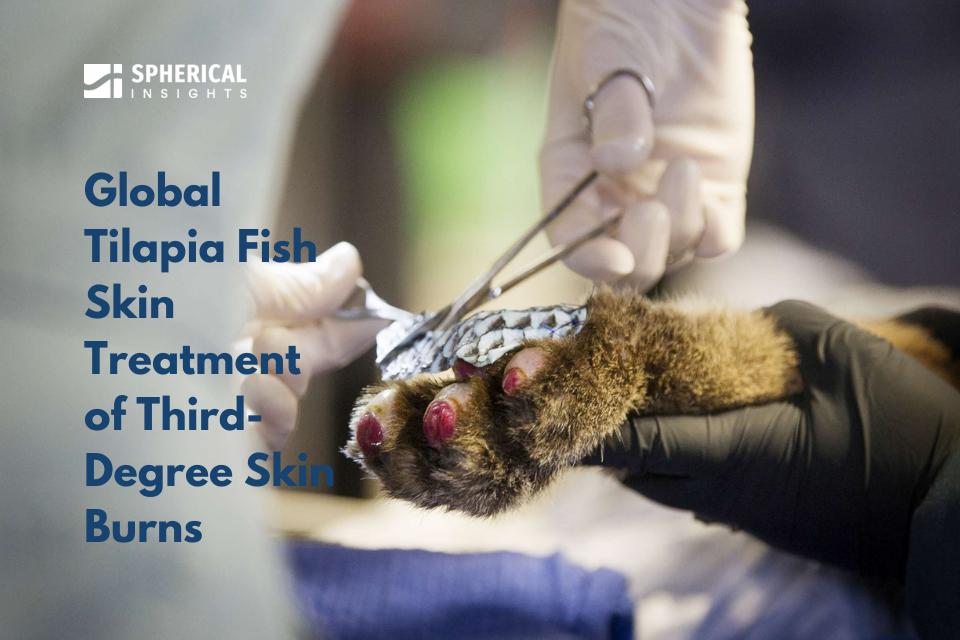 Global Tilapia Fish Skin Treatment of Third-Degree Skin Burns: News Brief By Spherical Insights and Consulting